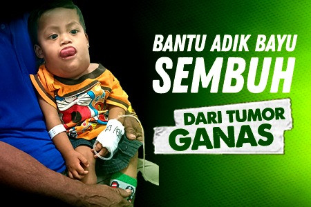 Campaign Tumor Ganas Gerogoti, Bantu Bayu Dan Anak Dhuafa Lainnya Bisa Sembuh