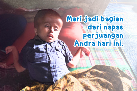 Dek andra, Kepala cacat Permanen dan terbaring dikasur